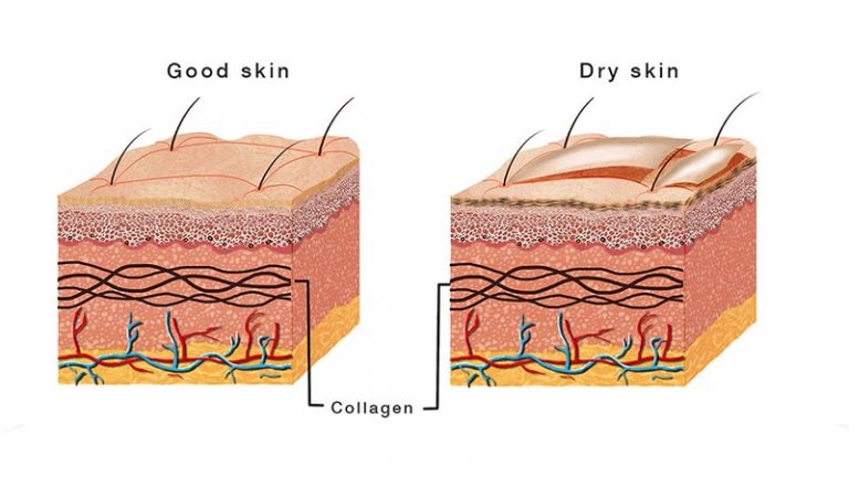 How Does Humidity Affect Your Skin? | Thermopro